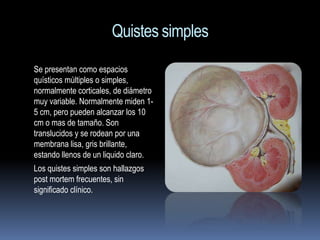 Quistes simples
Se presentan como espacios
quísticos múltiples o simples,
normalmente corticales, de diámetro
muy variable. Normalmente miden 1-
5 cm, pero pueden alcanzar los 10
cm o mas de tamaño. Son
translucidos y se rodean por una
membrana lisa, gris brillante,
estando llenos de un liquido claro.
Los quistes simples son hallazgos
post mortem frecuentes, sin
significado clínico.
 