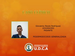 Giovanny Reyes Rodríguez
1032404393
PASANTE
PIODEMODICOSIS GENERALIZADA
 