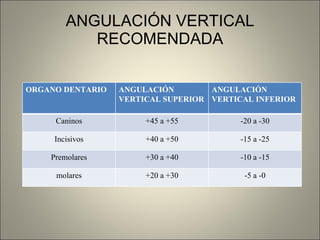 ANGULACIÓN VERTICAL RECOMENDADA ORGANO DENTARIO ANGULACIÓN VERTICAL SUPERIOR ANGULACIÓN VERTICAL INFERIOR Caninos +45 a +55 -20 a -30 Incisivos +40 a +50 -15 a -25 Premolares +30 a +40 -10 a -15 molares +20 a +30 -5 a -0 