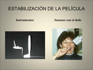 ESTABILIZACIÓN DE LA PELÍCULA Instrumentos  Sostener con el dedo 