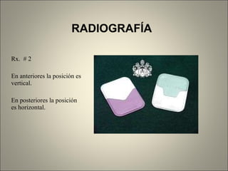 RADIOGRAFÍA Rx.  # 2 En anteriores la posición es vertical. En posteriores la posición es horizontal. 