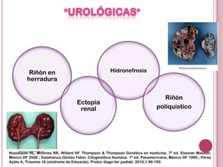 Riñón en                                  Hidronefrosis
         herradura


                                                                              Riñón
                                  Ectopia
                                   renal                                   poliquístico




Nussbaum RL, Mcinnes RR, Willard HF. Thompson & Thompson Genética en medicina. 7ª ed. Elsevier Masson,
México DF 2008.; Salamanca Gómez Fabio. Citogenética Humana. 1ª ed. Panamericana, México DF 1990.; Pérez
Aytés A, Trisomía 18 (síndrome de Edwards). Protoc diagn ter pediatr. 2010;1:96-100.
 