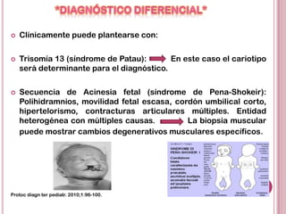    Clínicamente puede plantearse con:

   Trisomía 13 (síndrome de Patau):       En este caso el cariotipo
    será determinante para el diagnóstico.

   Secuencia de Acinesia fetal (síndrome de Pena-Shokeir):
    Polihidramnios, movilidad fetal escasa, cordón umbilical corto,
    hipertelorismo, contracturas articulares múltiples. Entidad
    heterogénea con múltiples causas.          La biopsia muscular
    puede mostrar cambios degenerativos musculares específicos.




Protoc diagn ter pediatr. 2010;1:96-100.
 