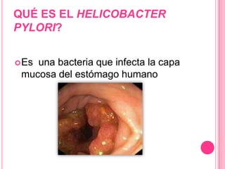 Determinantes de patogenidadLa toxina colérica es la principal responsable de la diarrea acuosa