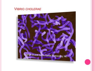 Cortos, curva y de gran movilidadmóviles por un flagelo   polar