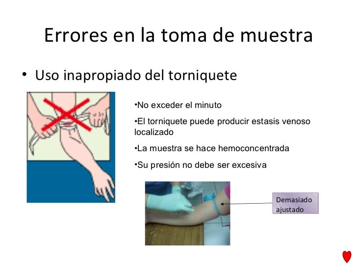 toma de muestra sanguinea