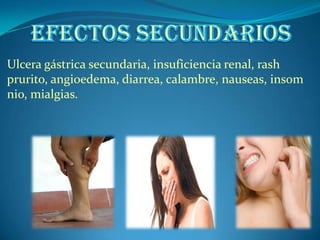 Ulcera gástrica secundaria, insuficiencia renal, rash
prurito, angioedema, diarrea, calambre, nauseas, insom
nio, mialgias.
 