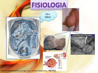 50 a
100ml

SABINSTON, Principios de Cirugía, Cap. 43 Pared Abdominal, Pág: 1139

 
