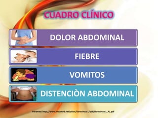 DOLOR ABDOMINAL
FIEBRE

VOMITOS
DISTENCIÒN ABDOMINAL
Intramed: http://www.intramed.net/sitios/librovirtual1/pdf/librovirtual1_42.pdf

 