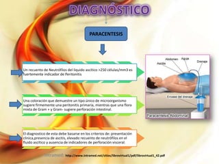 PARACENTESIS

Un recuento de Neutrófilos del liquido ascítico >250 células/mm3 es
fuertemente indicador de Peritonitis

Una coloración que demuestre un tipo único de microorganismo
sugiere firmemente una peritonitis primaria, mientras que una flora
mixta de Gram + y Gram- sugiere perforación intestinal.

El diagnostico de esta debe basarse en los criterios de: presentación
clinica,presencia de ascitis, elevado recuento de neutrófilos en el
fluido ascítico y ausencia de indicadores de perforación visceral.

Intramed: http://www.intramed.net/sitios/librovirtual1/pdf/librovirtual1_42.pdf

 