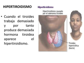 HIPERTIROIDISMO
• Cuando el tiroides
trabaja demasiado
y por tanto
produce demasiada
hormona tiroidea
aparece el
hipertiroidismo.
 