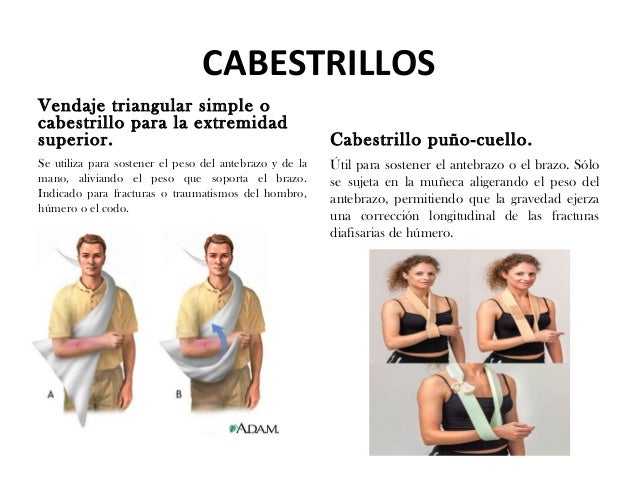Los rayos X sheynogo del departamento de la columna vertebral las proyecciones oblicuas