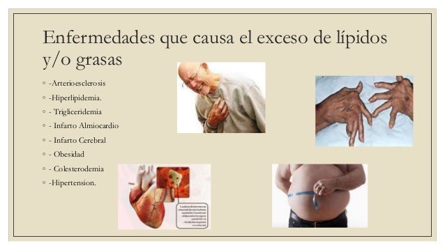 Exposicion