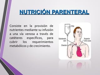 NUTRICIÓN PARENTERALNUTRICIÓN PARENTERAL
Consiste en la provisión de
nutrientes mediante su infusión
a una vía venosa a través de
catéteres específicos, para
cubrir los requerimientos
metabólicos y de crecimiento.
 
