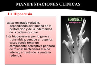 La Hipoacusia
existe en grado variable,
dependiendo del tamaño de la
perforación y de la indemnidad
de la cadena osicular
Esta hipoacusia es por lo general
transmisiva, aunque en algunos
casos puede tener un
componente perceptivo por paso
de toxinas bacterianas al oído
interno, a través de la ventana
redonda.
MANIFESTACIONES CLINICAS
 
