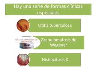 Hay una serie de formas clínicas
especiales
Otitis tuberculosa
Granulomatosis de
Wegener
Histiocitosis X
 