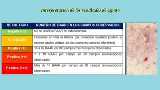 Interpretación de los resultados de esputo
 