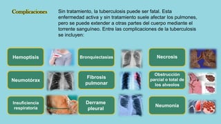 Complicaciones
Hemoptisis
Neumotórax
Insuficiencia
respiratoria
Bronquiectasias
Fibrosis
pulmonar
Derrame
pleural
Necrosis
Obstrucción
parcial o total de
los alveolos
Neumonía
Sin tratamiento, la tuberculosis puede ser fatal. Esta
enfermedad activa y sin tratamiento suele afectar los pulmones,
pero se puede extender a otras partes del cuerpo mediante el
torrente sanguíneo. Entre las complicaciones de la tuberculosis
se incluyen:
 