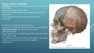 REGION LATERAL O TEMPORAL
Limitada por arriba y atrás por una línea curva (LINEA
TEMPORAL)
Existen dos líneas temporales:
*Línea temporal superior: se inserta la aponeurosis
temporal
*Línea temporal inferior: se inserta el musculo
temporal
Presenta una extensa abertura que:
*Comunica de forma directa con la fosa cigomática
*Esta circunscrita: por dentro por la cresta
esfenotemporal.
Hacia afuera por la apófisis cigomática del temporal
y el hueso malar
Por delante por la cara interna del hueso malar y por
detrás por la raíz transversa de la apófisis
cigomática.
 