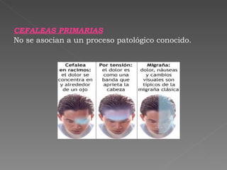 CEFALEAS PRIMARIAS No se asocian a un proceso patológico conocido.  