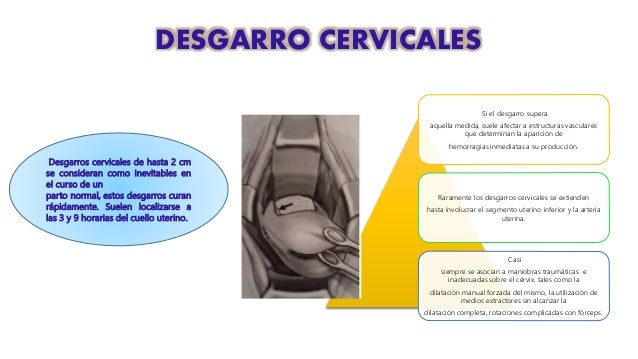 hemorragias post parto
