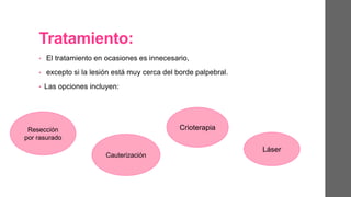 Tratamiento:
• El tratamiento en ocasiones es innecesario,
• excepto si la lesión está muy cerca del borde palpebral.
• Las opciones incluyen:
Resección
por rasurado
Cauterización
Crioterapia
Láser
 