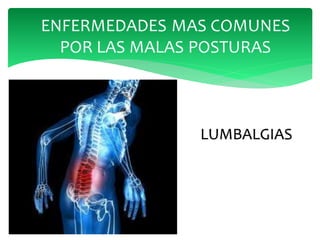 LUMBALGIAS
 