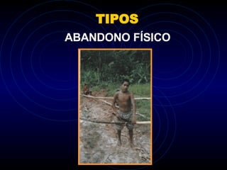 TIPOS ABANDONO FÍSICO 