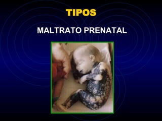 TIPOS MALTRATO PRENATAL 