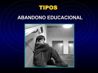 TIPOS ABANDONO EDUCACIONAL 