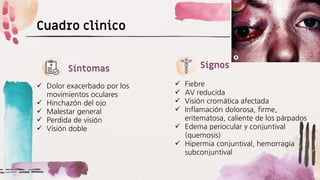 Cuadro clinico
✓ Dolor exacerbado por los
movimientos oculares
✓ Hinchazón del ojo
✓ Malestar general
✓ Perdida de visión
✓ Visión doble
Síntomas
✓ Fiebre
✓ AV reducida
✓ Visión cromática afectada
✓ Inflamación dolorosa, firme,
eritematosa, caliente de los párpados
✓ Edema periocular y conjuntival
(quemosis)
✓ Hipermia conjuntival, hemorragia
subconjuntival
Signos
 