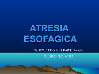 ATRESIA
ESOFAGICA
 Dr. EDUARDO MALPARTIDA CH.
      MEDICO PEDIATRA
 