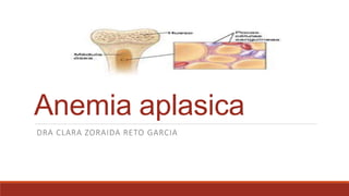 Anemia aplasica
DRA CLARA ZORAIDA RETO GARCIA
 