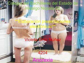 Colegio del Bachilleres del Estado de Hidalgo Nopala 02 **Elaboración presentaciones electrónicas** Violeta Ortiz Núñez 4204 Anorexia 
