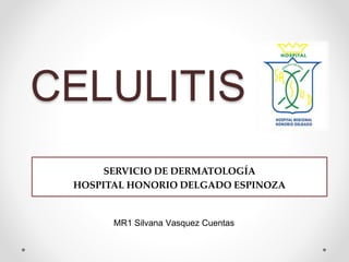 CELULITIS
SERVICIO DE DERMATOLOGÍA
HOSPITAL HONORIO DELGADO ESPINOZA
MR1 Silvana Vasquez Cuentas
 