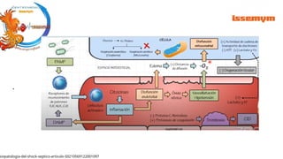 .
siopatologia-del-shock-septico-articulo-S0210569122001097
 