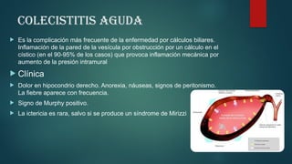 Colecistitis aguda
 Es la complicación más frecuente de la enfermedad por cálculos biliares.
Inflamación de la pared de la vesícula por obstrucción por un cálculo en el
cístico (en el 90-95% de los casos) que provoca inflamación mecánica por
aumento de la presión intramural
 Clínica
 Dolor en hipocondrio derecho. Anorexia, náuseas, signos de peritonismo.
La fiebre aparece con frecuencia.
 Signo de Murphy positivo.
 La ictericia es rara, salvo si se produce un síndrome de Mirizzi
 