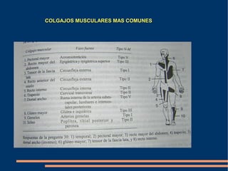 COLGAJOS MUSCULARES MAS COMUNES
 