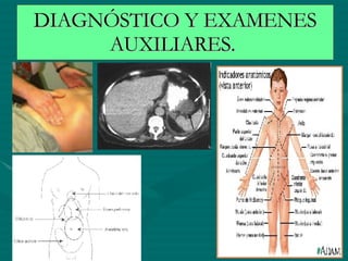 DIAGNÓSTICO Y EXAMENES AUXILIARES.  