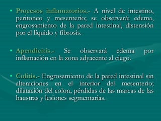 Procesos inflamatorios.-  A nivel de intestino, peritoneo y mesenterio; se observará: edema, engrosamiento de la pared intestinal, distensión por el líquido y fibrosis. Apendicitis.-  Se observará edema por inflamación en la zona adyacente al ciego. Colitis.-  Engrosamiento de la pared intestinal sin alteraciones en el interior del mesenterio; dilatación del colon, pérdidas de las marcas de las haustras y lesiones segmentarias. 