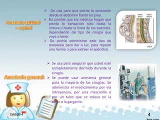  Se usa para que pierda la sensación
desde el abdomen hasta los pies.
 Es posible que los médicos hagan que
pierda la sensación sólo hasta la
cintura o hasta la línea de los pezones,
dependiendo del tipo de cirugía que
vaya a tener.
 Se podría administrar este tipo de
anestesia para dar a luz, para reparar
una hernia o para extraer el apéndice.
 Se usa para asegurar que usted esté
completamente dormido durante la
cirugía.
 Se puede usar anestesia general
para la mayoría de las cirugías. Se
administra el medicamento por vía
intravenosa, por una mascarilla o
por un tubo que se coloca en la
nariz o la garganta.
13/05/2014 4
 