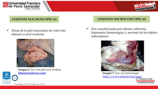LESIONES MICROCOSCOPICAS
LESIONES MACROSCOPICAS
 Áreas de la piel maceradas de color rojo
obscuro o azul verdosas
Imagen 6. Ave con piel azul verdosa
https://criadeaves.com/
 Son caracterizadas por edema, enfisema,
hiperemia, hemorragias, y necrosis de los tejidos
subcutáneos
Imagen 7. Ave con hemorragia
https://www.elsitioavicola.com/
 