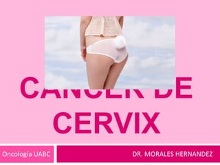 CANCER DE
CERVIX
Oncología UABC

DR. MORALES HERNANDEZ

 