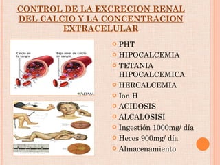 CONTROL DE LA EXCRECION RENAL DEL CALCIO Y LA CONCENTRACION EXTRACELULAR PHT HIPOCALCEMIA TETANIA HIPOCALCEMICA HERCALCEMIA Ion H ACIDOSIS ALCALOSISI Ingestión 1000mg/ día Heces 900mg/ día Almacenamiento