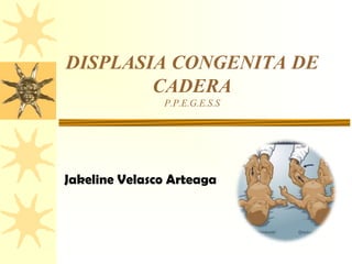 DISPLASIA CONGENITA DE
CADERA
P.P.E.G.E.S.S
Jakeline Velasco Arteaga
 