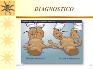 DIAGNOSTICO
11/07/2013 10
 