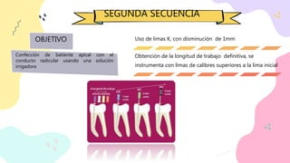 SEGUNDA SECUENCIA
OBJETIVO
Confección de batiente apical con el
conducto radicular usando una solución
irrigadora
Uso de limas K, con disminución de 1mm
Obtención de la longitud de trabajo definitiva, se
instrumenta con limas de calibres superiores a la lima inicial
 