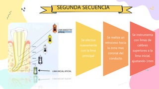 SEGUNDA SECUENCIA
Se efectúa
nuevamente
con la lima
principal
Se realiza un
retroceso hacia
la zona mas
coronal del
conducto
Se instrumenta
con limas de
calibres
superiores a la
lima inicial,
ajustando 1mm
 