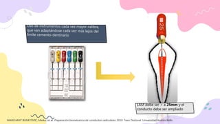LAM debe ser > a 25mm y el
conducto debe ser ampliado
MARCHANT BURATOVIC, Marko, et al. Preparación biomécanica de conductos radiculares. 2010. Tesis Doctoral. Universidad Andrés Bello.
 