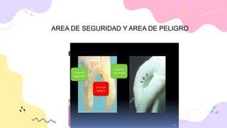 AREA DE SEGURIDAD Y AREA DE PELIGRO
 